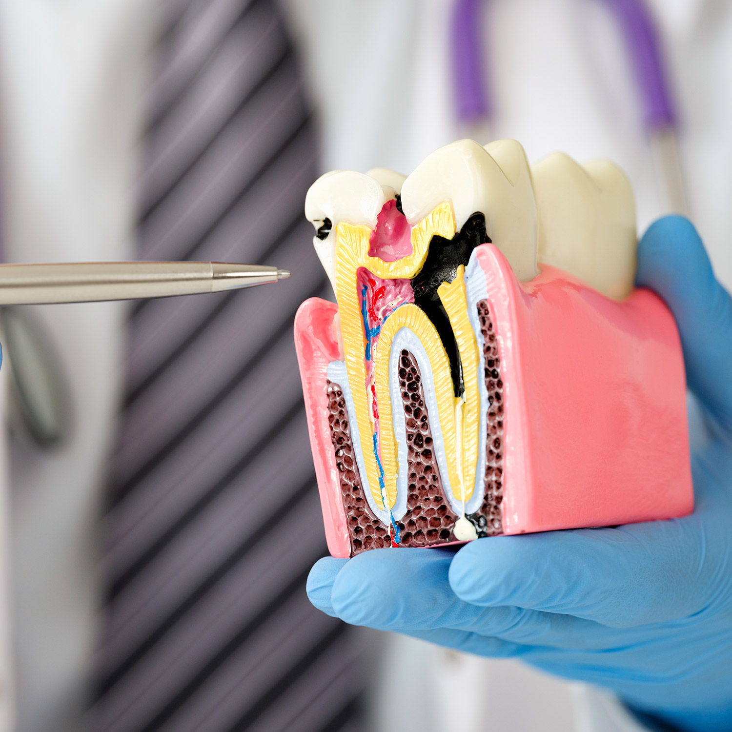 Endodoncia